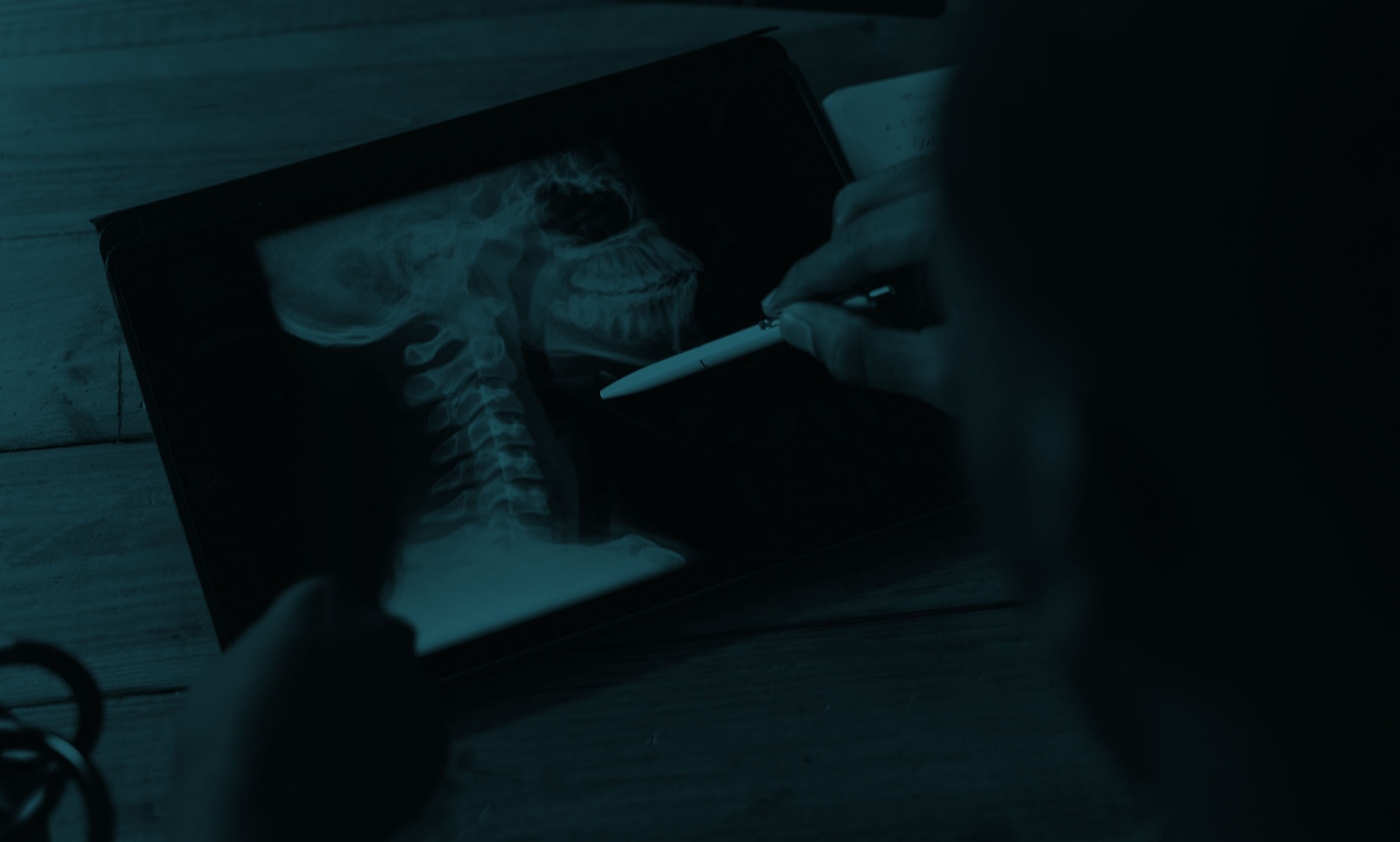 Personal Injury